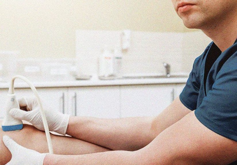 Arterial Thrombosis: Symptoms, Prevention, Treatment, and More