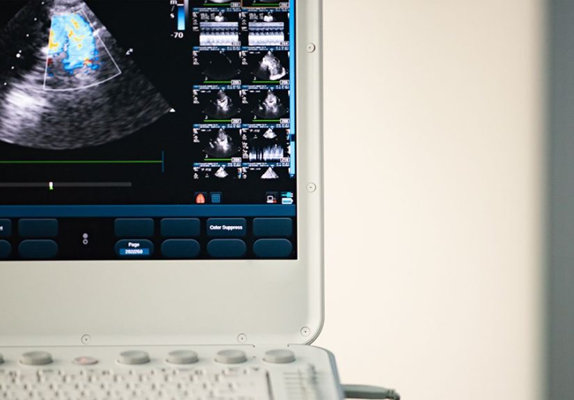Medicare and Echocardiogram: Coverage Details