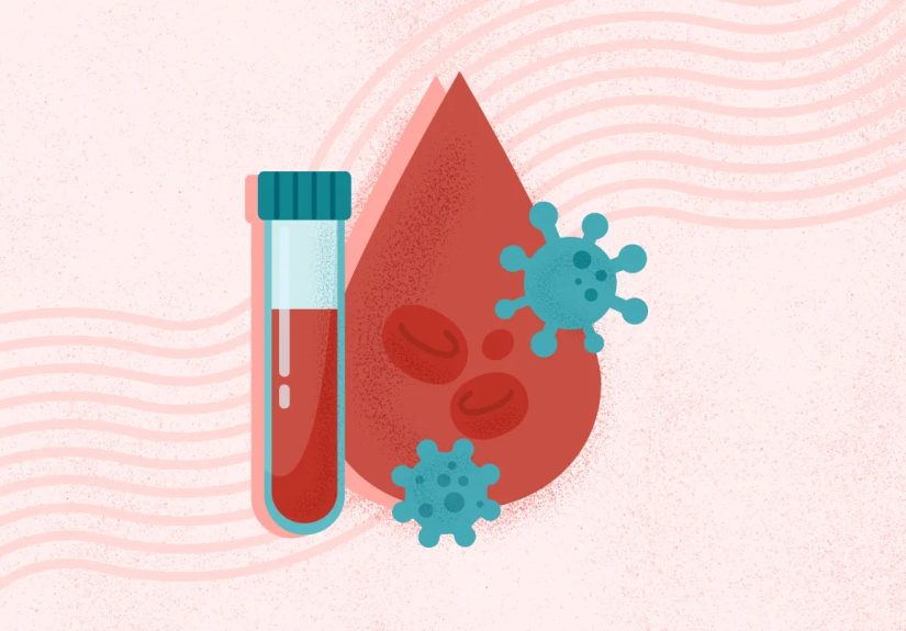 What Is HIV? Symptoms, Causes, Diagnosis, Treatment, and Prevention
