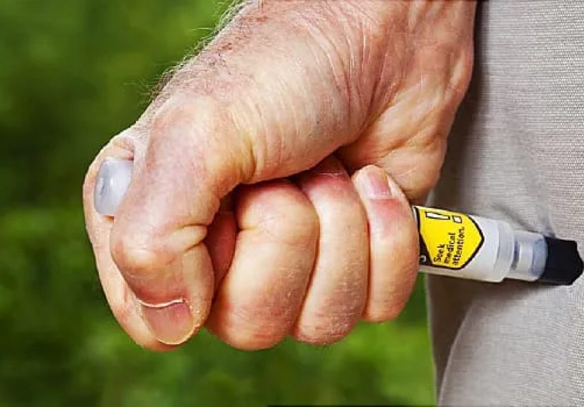 Anaphylaxis Symptoms and Causes (Food, Stings, and More)