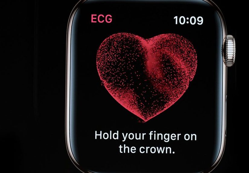 Apple Watch Heart Monitor