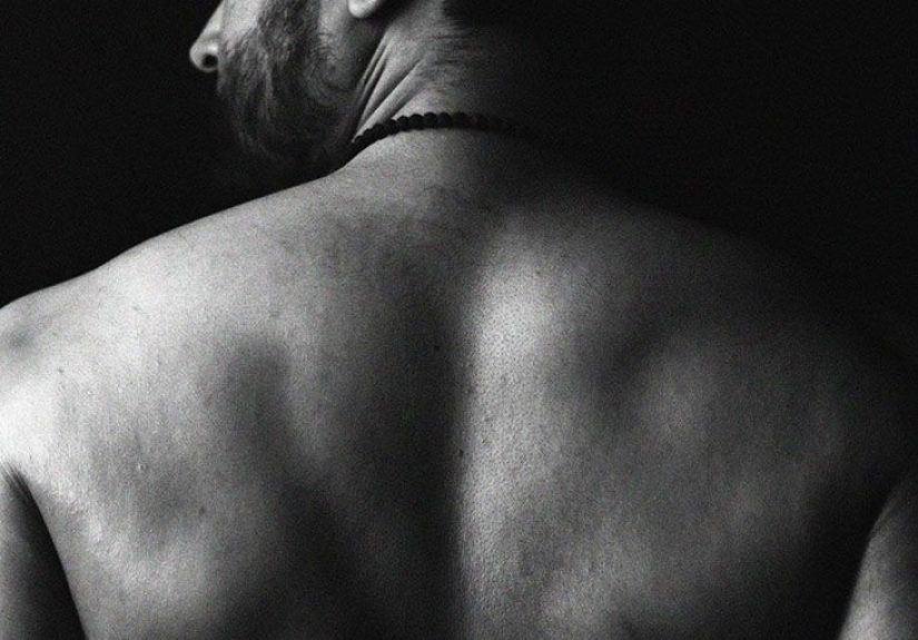 Can Back Pain Be a Symptom of Prostate Cancer?