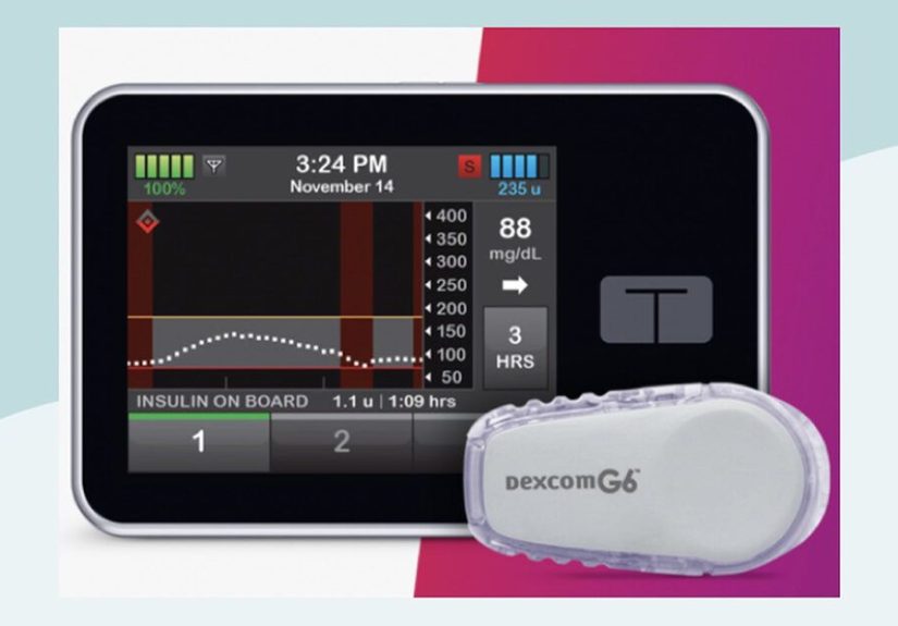t:slim X2 Insulin Pump Review