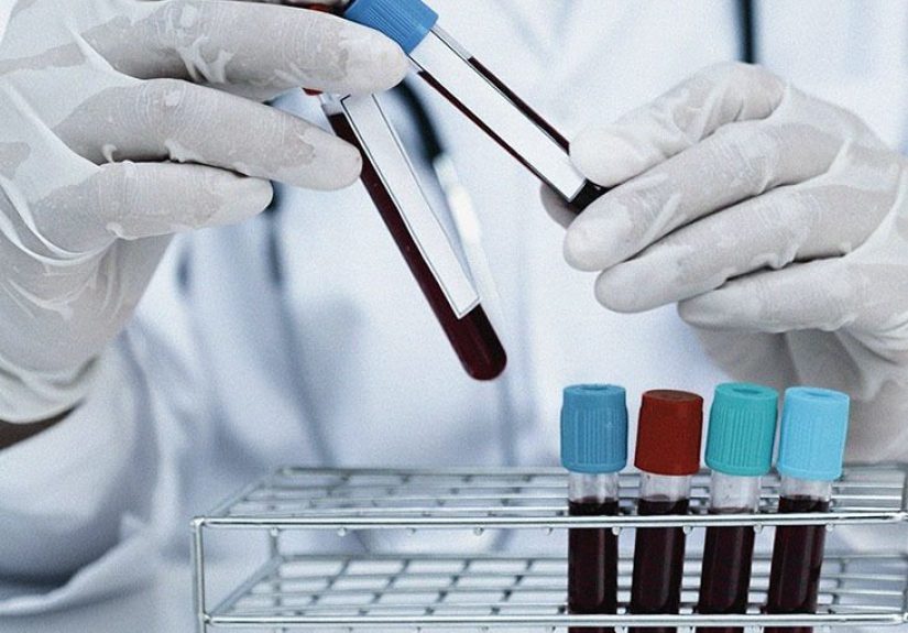 Upper GI bleed: Symptoms, causes, diagnosis, and treatments