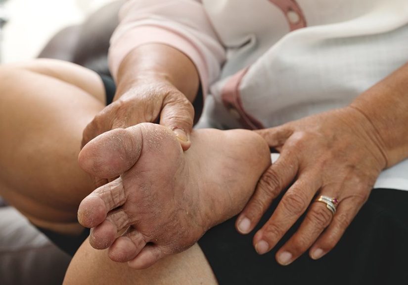What Is Treatment Induced Diabetic Neuropathy?
