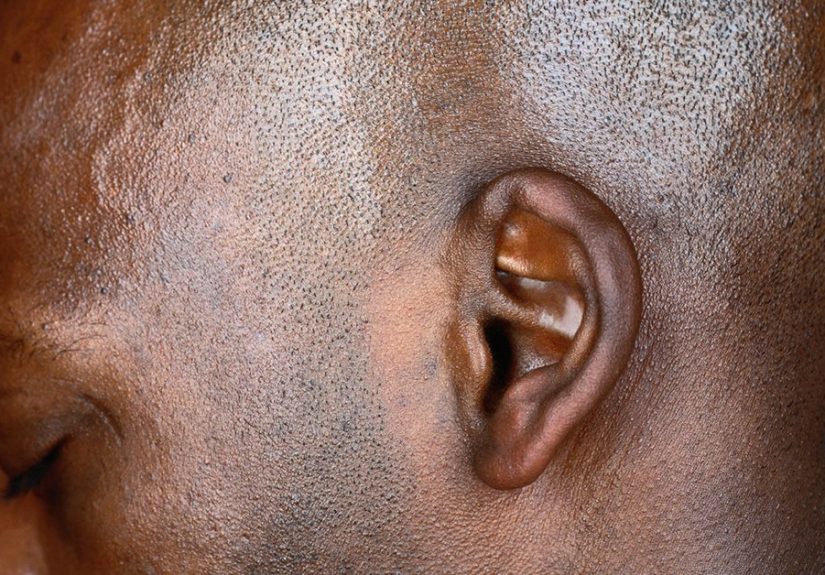 Why are my ears crackling and what to do about it?