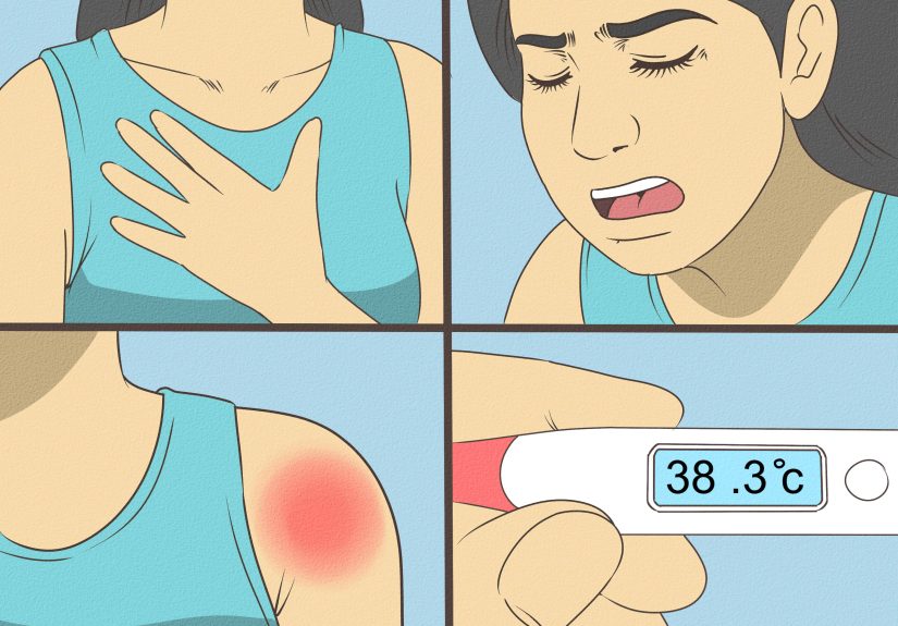 3 Ways to Treat Swelling