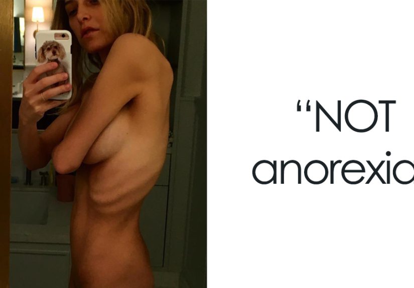 90 Brutally Honest Photos Of Post-Baby Bodies