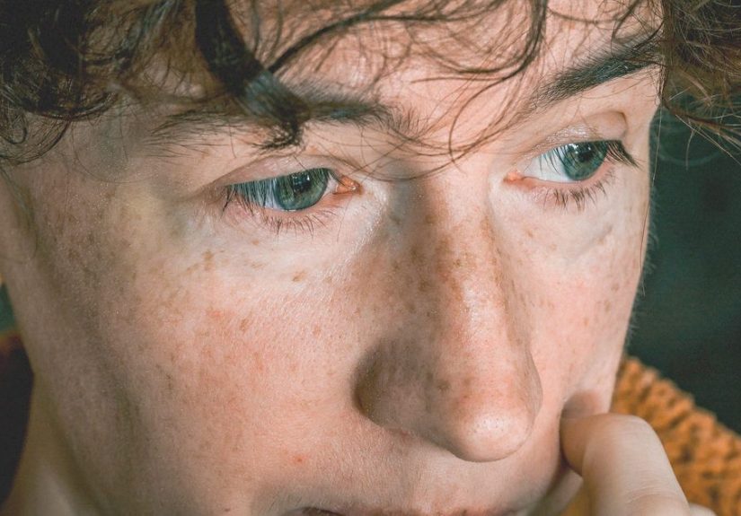 Atrophic Rhinitis: Treatment, Causes, and Surgery