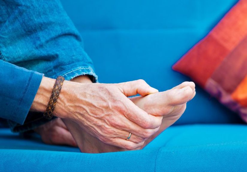 Bunions: Causes, Symptoms, and Diagnosis