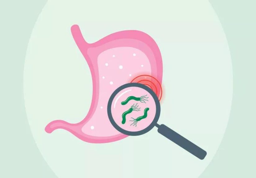 Can Stress Cause Stomach Ulcers?