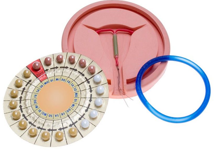 Emergency Contraception Options: Hormonal Pills vs IUD