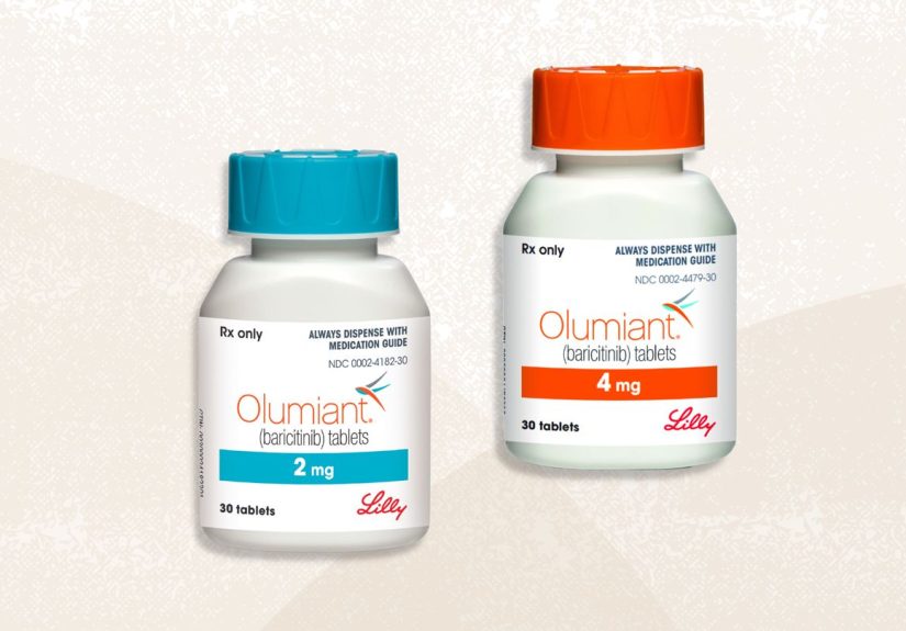 FDA Approves New Treatment for Hair Loss From Severe Alopecia Areata