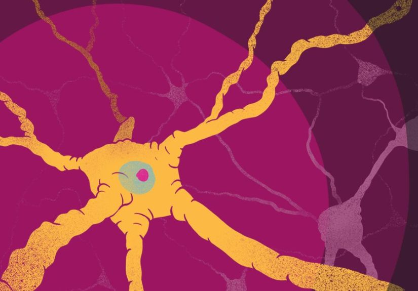 How Multiple Sclerosis Affects White and Gray Matter in the Brain