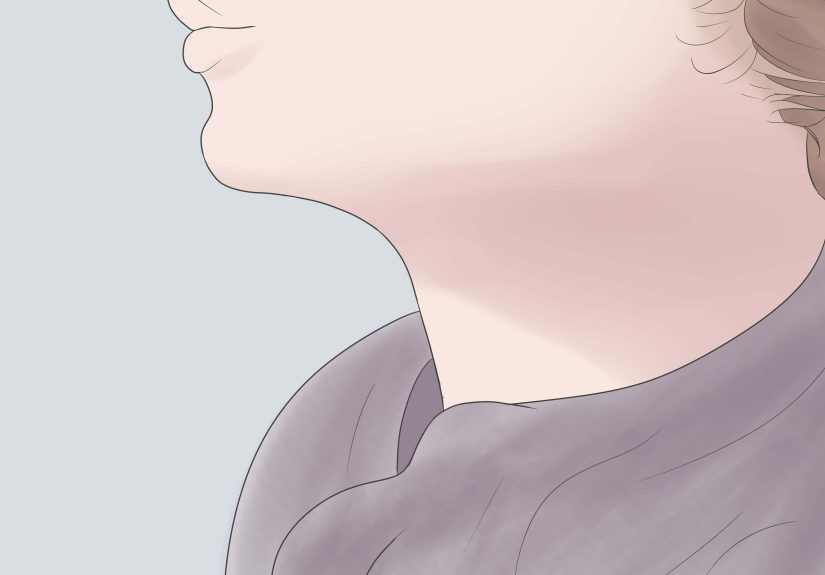 How to Get Rid of a Hickey Fast: Quickest Healing Hacks