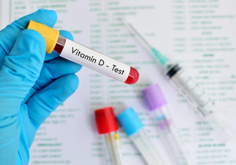 Importance of Vitamin D: Why You Can't Afford to Skip This Vital Nutrient