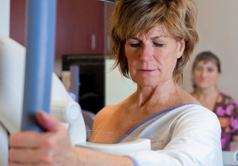 Lobular Breast Cancer Prognosis and Survival Rates