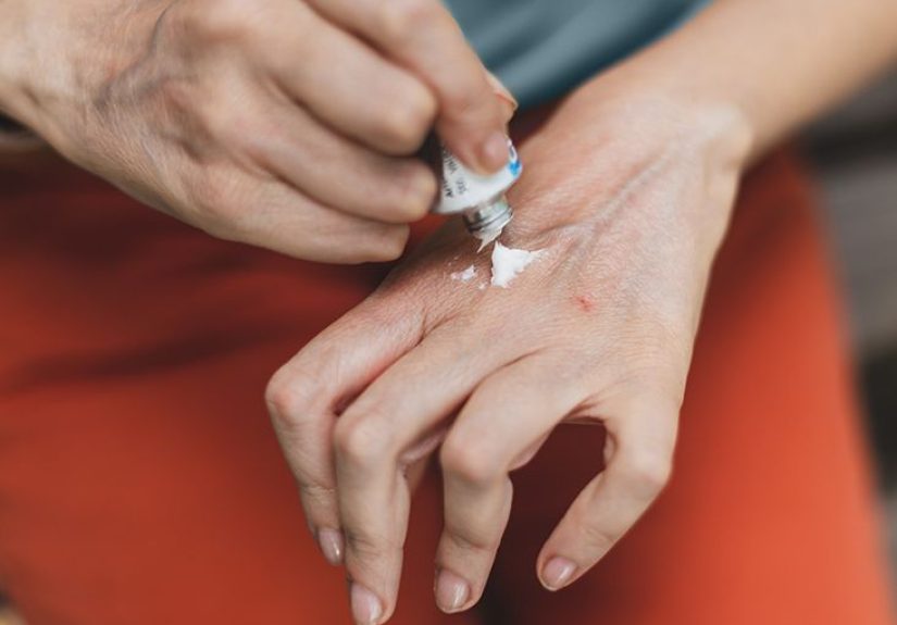 Rheumatoid Arthritis Itching Attacks: Causes and Relief Tips