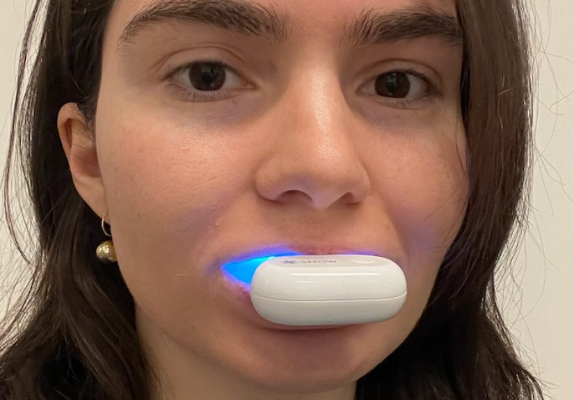 Snow Teeth Whitening Kit Review 2024: My Before & After Results