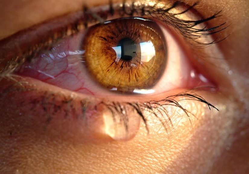 Tear Burns: Why Do My Eyes Burn When I Cry?