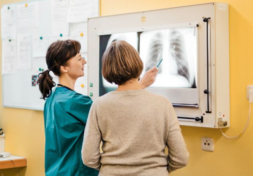Cáncer de células no pequeñas: Mutaciones y tratamientos