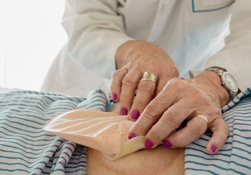 Do Colostomy Bags Smell? FAQ and What to Do