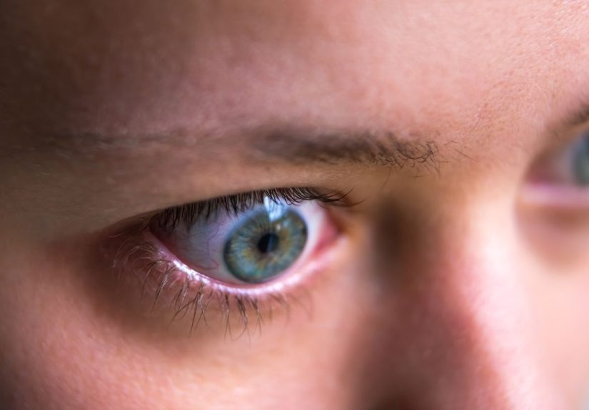 Facts About Thyroid Eye Disease