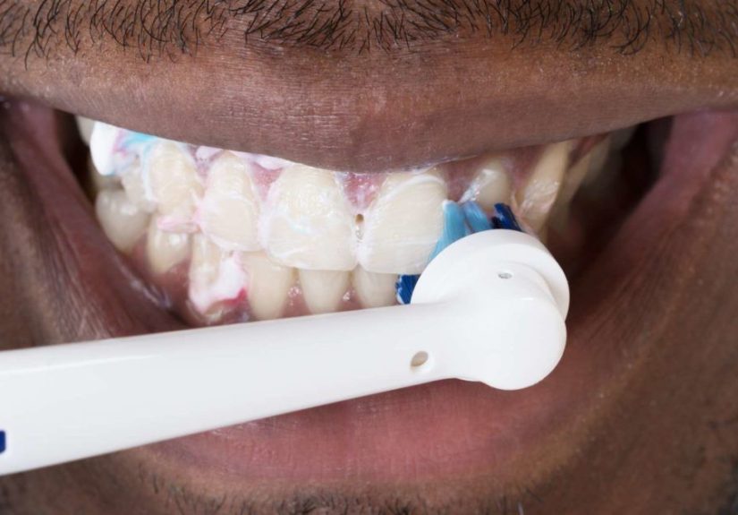 Home remedies for sensitive teeth plus causes and prevention
