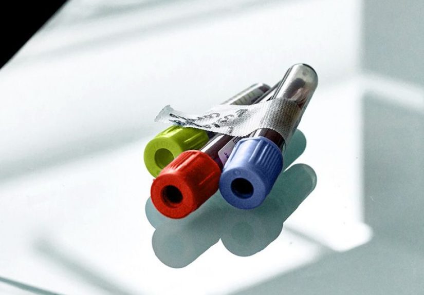 Lung cancer: How a simple blood test can help detect disease earlier