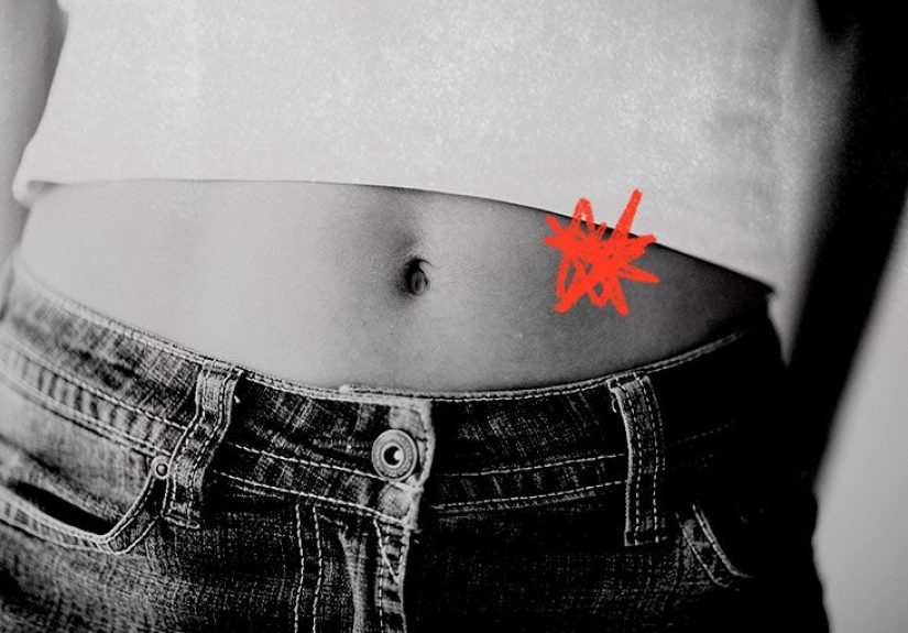 Ulcerative Colitis Pain Location: Symptoms, Causes, Personal Story