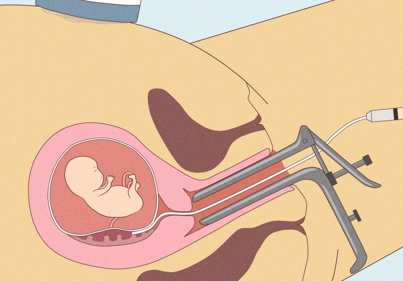 4 Ways to Tell if a Baby Is a Boy or Girl by the Heartbeat
