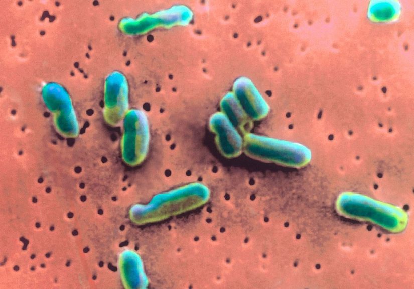 CDC Warns Drug-Resistant Shigella Bacteria Is Causing More Stomach Infections