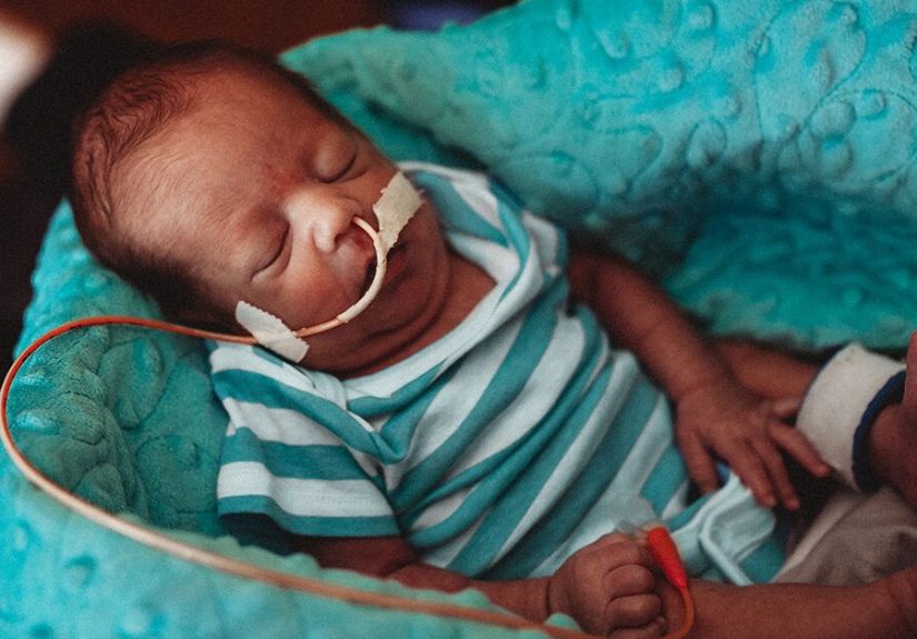 Feeding Tube for Infants: Conditions, Procedure, and Risks