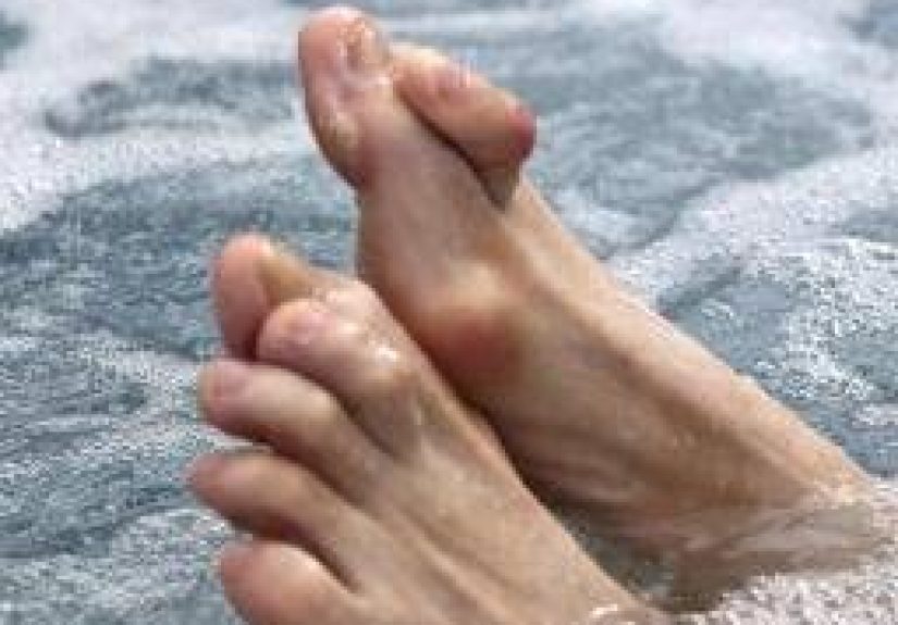 Hammer Toe Surgery: Types, What to Expect, and Recovery