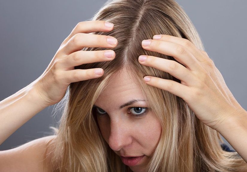 Ingrown Hair: On Scalp