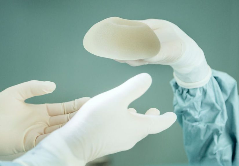 Breast Implant Cancer: Risk Factors, Symptoms, and Treatment