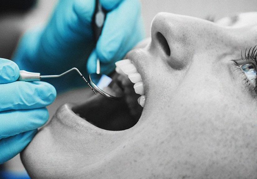 Exposed Tooth Root: Symptoms, Treatment, Pictures, and More