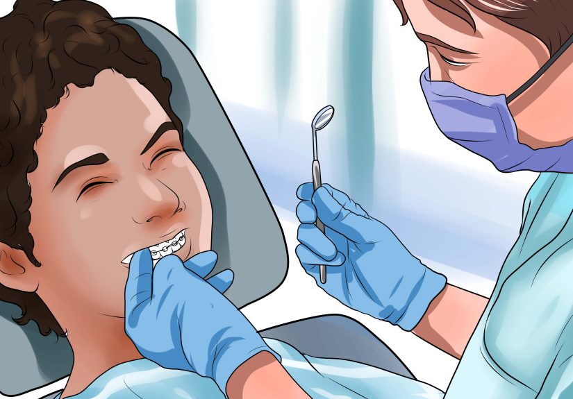 How to Clean Teeth With Braces: 12 Steps